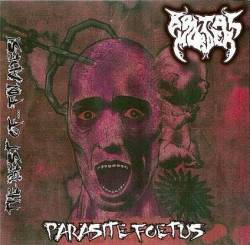 Brutal Murder : Parasite Foetus